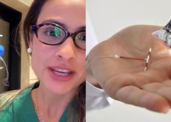 Ginecologista encontra pelos de gato em DIU de paciente